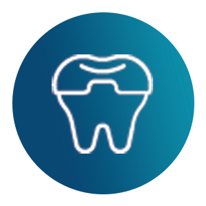 Veneers